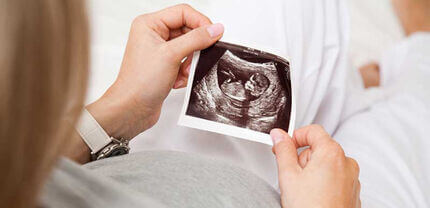 Pregnancy ultrasound scan