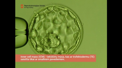 ICM (Inner cell mass) - iekššūnu masa