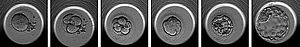 EmbryoScope